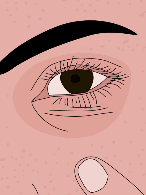 illustration of person with dark circles around eyes