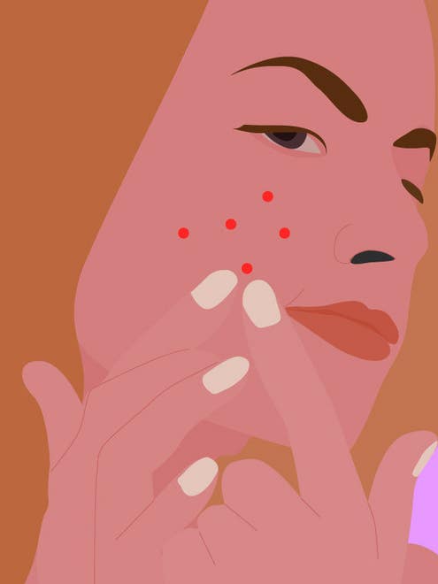 illustration of woman squeezing acne
