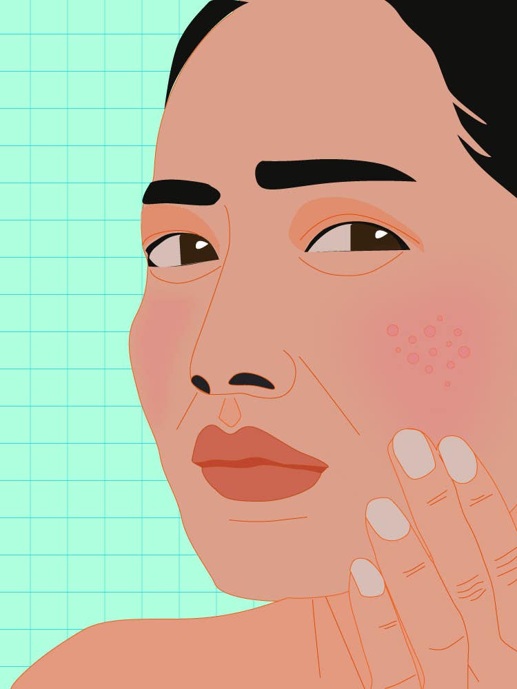 Your Skin Might Be Irritated and You Don’t Even Know It